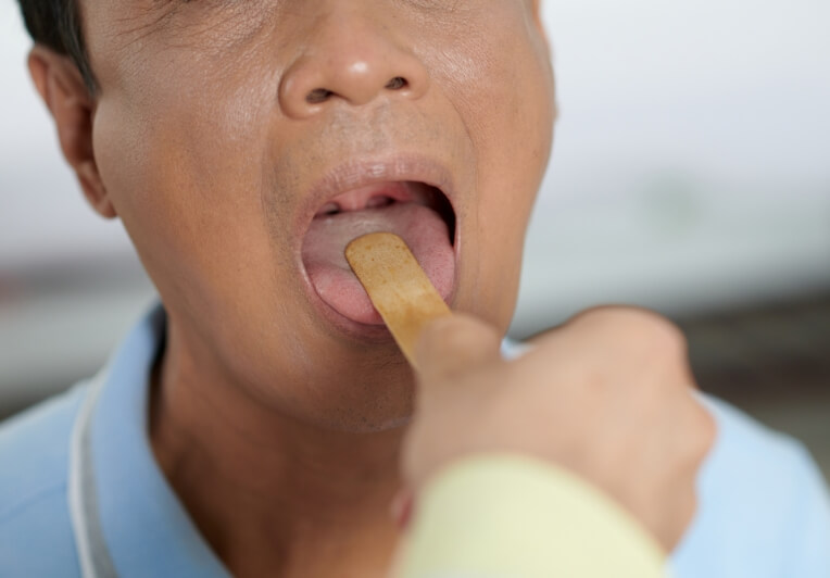 舌下免疫療法開始
