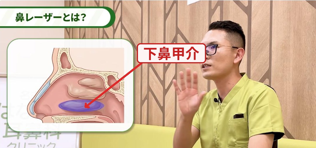 鼻の断面イラスト。紫色の部分が下鼻甲介